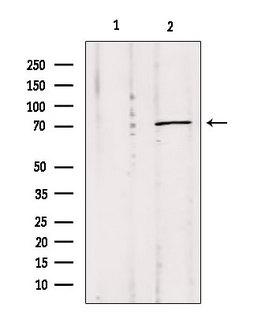 MPP5 Antibody - Western blot analysis of extracts of mouse Myeloma cells using MPP5 antibody. Lane 1 was treated with the blocking peptide.