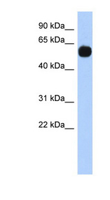 MPP7 Antibody - MPP7 antibody Western blot of HT1080 cell lysate. This image was taken for the unconjugated form of this product. Other forms have not been tested.