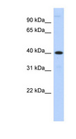MPPE1 / PGAP5 Antibody - MPPE1 antibody Western blot of Transfected 293T cell lysate. This image was taken for the unconjugated form of this product. Other forms have not been tested.