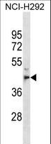 MPPE1 / PGAP5 Antibody - MPPE1 Antibody western blot of NCI-H292 cell line lysates (35 ug/lane). The MPPE1 antibody detected the MPPE1 protein (arrow).