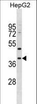 MPPED1 Antibody - MPPED1 Antibody western blot of HepG2 cell line lysates (35 ug/lane). The MPPED1 antibody detected the MPPED1 protein (arrow).