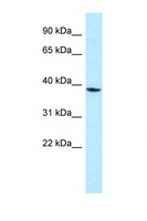 MPPED1 Antibody - MPPED1 antibody Western blot of Jurkat Cell lysate. Antibody concentration 1 ug/ml.  This image was taken for the unconjugated form of this product. Other forms have not been tested.