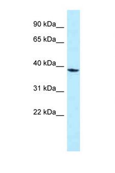 MPPED1 Antibody - MPPED1 antibody Western blot of Jurkat Cell lysate. Antibody concentration 1 ug/ml.  This image was taken for the unconjugated form of this product. Other forms have not been tested.