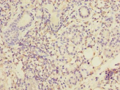 MPPED1 Antibody - Immunohistochemistry of paraffin-embedded human pancreatic tissue using antibody at dilution of 1:100.