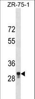 MPPED2 Antibody - MPPED2 Antibody western blot of ZR-75-1 cell line lysates (35 ug/lane). The MPPED2 antibody detected the MPPED2 protein (arrow).