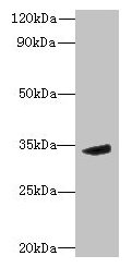 MPPED2 Antibody - Western blot All lanes: MPPED2 antibody at 6µg/ml + Mouse brain tissue Secondary Goat polyclonal to rabbit IgG at 1/10000 dilution Predicted band size: 34, 32 kDa Observed band size: 34 kDa
