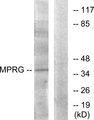 MPRG / PAQR5 Antibody - Western blot analysis of lysates from HUVEC cells, using MPRG Antibody. The lane on the right is blocked with the synthesized peptide.
