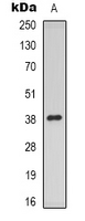 MPRG / PAQR5 Antibody - Western blot analysis of mPR gamma expression in HUVEC (A) whole cell lysates.