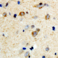 MPRG / PAQR5 Antibody - Immunohistochemical analysis of mPR gamma staining in human brain formalin fixed paraffin embedded tissue section. The section was pre-treated using heat mediated antigen retrieval with sodium citrate buffer (pH 6.0). The section was then incubated with the antibody at room temperature and detected using an HRP polymer system. DAB was used as the chromogen. The section was then counterstained with hematoxylin and mounted with DPX.