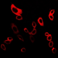 MPRG / PAQR5 Antibody - Immunofluorescent analysis of mPR gamma staining in LOVO cells. Formalin-fixed cells were permeabilized with 0.1% Triton X-100 in TBS for 5-10 minutes and blocked with 3% BSA-PBS for 30 minutes at room temperature. Cells were probed with the primary antibody in 3% BSA-PBS and incubated overnight at 4 deg C in a humidified chamber. Cells were washed with PBST and incubated with a DyLight 594-conjugated secondary antibody (red) in PBS at room temperature in the dark. DAPI was used to stain the cell nuclei (blue).