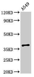 MPRG / PAQR5 Antibody - Western Blot Positive WB detected in: A549 whole cell lysate All lanes: PAQR5 antibody at 2.5µg/ml Secondary Goat polyclonal to rabbit IgG at 1/50000 dilution Predicted band size: 39 kDa Observed band size: 39 kDa