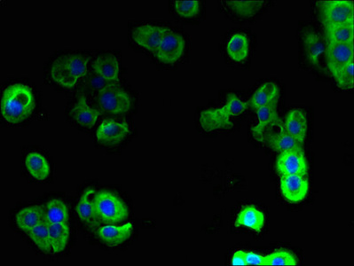 MPRG / PAQR5 Antibody - Immunofluorescent analysis of A431 cells using PAQR5 Antibody at dilution of 1:100 and Alexa Fluor 488-congugated AffiniPure Goat Anti-Rabbit IgG(H+L)