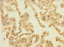 MPRG / PAQR5 Antibody - Immunohistochemistry of paraffin-embedded human lung tissue using PAQR5 Antibody at dilution of 1:100