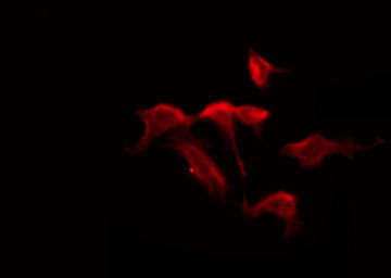 MPRG / PAQR5 Antibody - Staining HuvEc cells by IF/ICC. The samples were fixed with PFA and permeabilized in 0.1% Triton X-100, then blocked in 10% serum for 45 min at 25°C. The primary antibody was diluted at 1:200 and incubated with the sample for 1 hour at 37°C. An Alexa Fluor 594 conjugated goat anti-rabbit IgG (H+L) Ab, diluted at 1/600, was used as the secondary antibody.