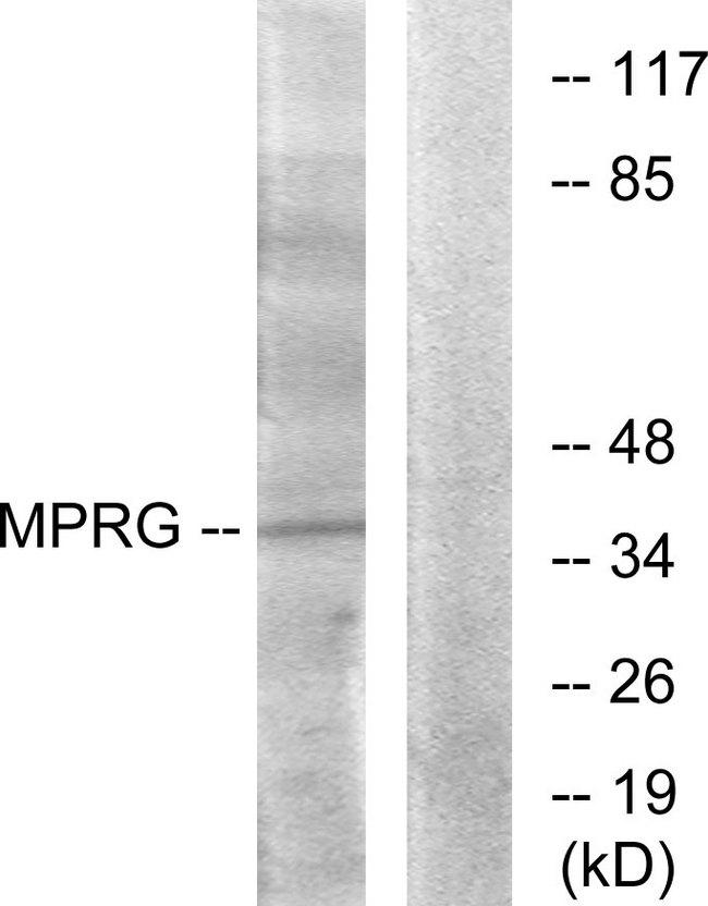 MPRG / PAQR5 Antibody - Western blot analysis of extracts from HUVEC cells, using MPRG antibody.