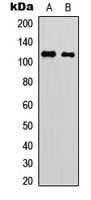 MPRIP / RIP3 Antibody - Western blot analysis of p116 Rip expression in Jurkat (A); rat muscle (B) whole cell lysates.
