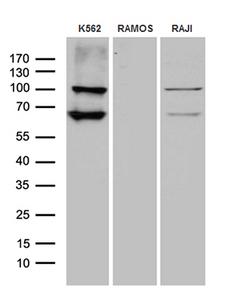 MPS1 / TTK Antibody - Western blot analysis of extracts. (35ug) from 3 different cell lines by using anti-TTK monoclonal antibody. (1:500)