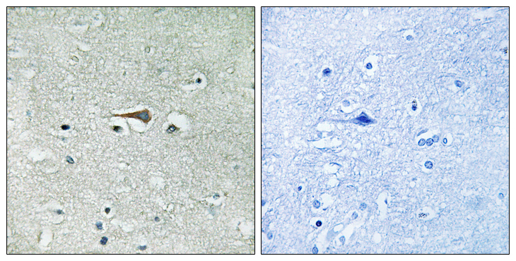 MPS1 / TTK Antibody - Immunohistochemistry analysis of paraffin-embedded human brain tissue, using TTK Antibody. The picture on the right is blocked with the synthesized peptide.