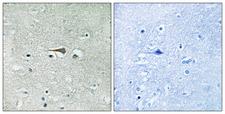 MPS1 / TTK Antibody - Immunohistochemistry analysis of paraffin-embedded human brain tissue, using TTK Antibody. The picture on the right is blocked with the synthesized peptide.