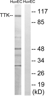MPS1 / TTK Antibody - Western blot analysis of lysates from HUVEC cells, treated with etoposide 25uM 24H, using TTK Antibody. The lane on the right is blocked with the synthesized peptide.