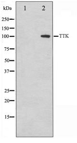 MPS1 / TTK Antibody - Western blot of HUVEC cell lysate using TTK Antibody