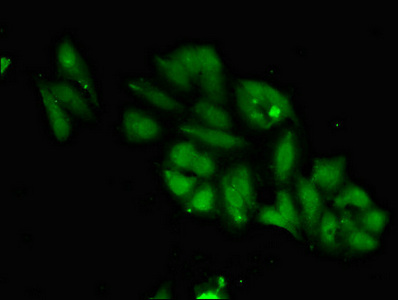MPS1 / TTK Antibody - Immunofluorescent analysis of Hela cells diluted at 1:100 and Alexa Fluor 488-congugated AffiniPure Goat Anti-Rabbit IgG(H+L)