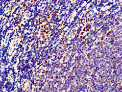 MPS1 / TTK Antibody - Immunohistochemistry of paraffin-embedded human lymph node tissue at dilution of 1:100