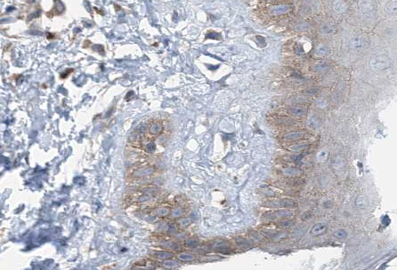MPS1 / TTK Antibody - 1:100 staining human skin tissue by IHC-P. The tissue was formaldehyde fixed and a heat mediated antigen retrieval step in citrate buffer was performed. The tissue was then blocked and incubated with the antibody for 1.5 hours at 22°C. An HRP conjugated goat anti-rabbit antibody was used as the secondary.