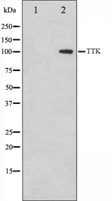 MPS1 / TTK Antibody - Western blot analysis on HuvEc cell lysates using TTK antibody. The lane on the left is treated with the antigen-specific peptide.