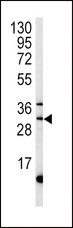 MPST Antibody - Western blot of MPST antibody in mouse liver tissue lysates (35 ug/lane). MPST (arrow) was detected using the purified antibody.