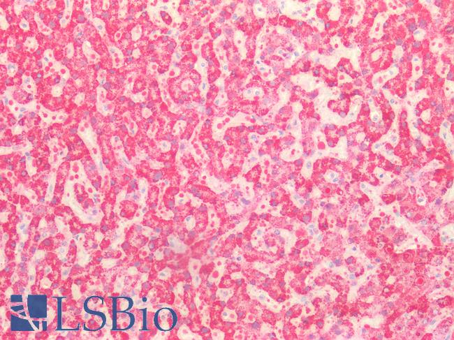MPST Antibody - Human Liver: Formalin-Fixed, Paraffin-Embedded (FFPE)