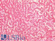 MPST Antibody - Human Liver: Formalin-Fixed, Paraffin-Embedded (FFPE)
