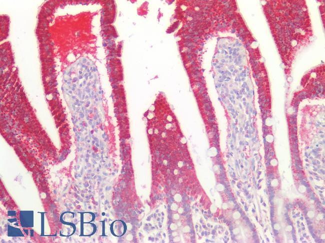 MPST Antibody - Human Small Intestine: Formalin-Fixed, Paraffin-Embedded (FFPE)