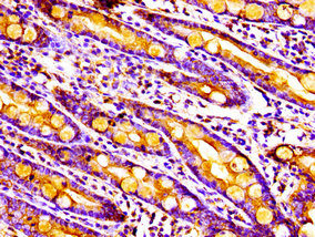 MPST Antibody - Immunohistochemistry image of paraffin-embedded human small intestine tissue at a dilution of 1:100