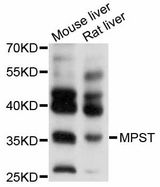 MPST Antibody - Western blot analysis of extracts of various cell lines, using MPST antibody at 1:1000 dilution. The secondary antibody used was an HRP Goat Anti-Rabbit IgG (H+L) at 1:10000 dilution. Lysates were loaded 25ug per lane and 3% nonfat dry milk in TBST was used for blocking. An ECL Kit was used for detection and the exposure time was 3s.