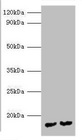 MPT63 Antibody - Western blot All Lanes:Immunogenic protein MPT63 antibody at 2ug/ml Lane 1: Recombinant Mycobacterium tuberculosis Immunogenic protein MPT63 protein 1ug Lane 2: Recombinant Mycobacterium tuberculosis Immunogenic protein MPT63 protein 0.1ug Secondary Goat polyclonal to rabbit IgG at 1/10000 dilution Predicted band size: 17kDa Observed band size: 17kDa