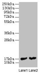 MPT63 Antibody - Western blot All lanes: Immunogenic protein MPT63 antibody at 2µg/ml Lane 1: Recombinant Mycobacterium tuberculosis Immunogenic protein MPT63 protein 1µg Lane 2: Recombinant Mycobacterium tuberculosis Immunogenic protein MPT63 protein 0.1µg Secondary Goat polyclonal to rabbit IgG at 1/10000 dilution Predicted band size: 17 kDa Observed band size: 17 kDa