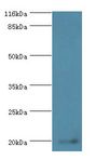 MPV17 Antibody - Western blot. All lanes: Protein Mpv17 antibody at 2 ug/ml+mouse heart tissue. Secondary antibody: goat polyclonal to rabbit at 1:10000 dilution. Predicted band size: 20 kDa. Observed band size: 20 kDa.  This image was taken for the unconjugated form of this product. Other forms have not been tested.