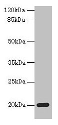 MPV17 Antibody - Western blot All lanes: Protein Mpv17 antibody at 2µg/ml + Mouse heart tissue Secondary Goat polyclonal to rabbit IgG at 1/10000 dilution Predicted band size: 20 kDa Observed band size: 20 kDa