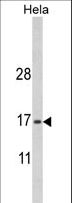 MPV17 Antibody - Western blot of MPV17 Antibody in HeLa cell line lysates (35 ug/lane). MPV17 (arrow) was detected using the purified antibody.