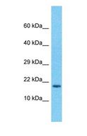MPV17 Antibody - Western blot of MPV17 Antibody with human ACHN Whole Cell lysate.  This image was taken for the unconjugated form of this product. Other forms have not been tested.
