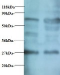 MPZ / P0 Antibody - Western blot of Myelin protein P0 antibody at 2 ug/ml. Lane 1:293T whole cell lysate. Lane 2: EC109 whole cell lysate. Secondary: Goat polyclonal to Rabbit IgG at 1:15000 dilution. Predicted band size: 27.3 kDa. Observed band size: 27.3 kDa Additional bands at: 75 kDa. We are unsure as to the identity of this extra band.  This image was taken for the unconjugated form of this product. Other forms have not been tested.