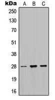 MPZ / P0 Antibody - Western blot analysis of MPZ expression in HeLa (A); SP2/0 (B); PC12 (C) whole cell lysates.