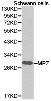 MPZ / P0 Antibody - Western blot of extracts of Schwann cell lines, using MPZ antibody.