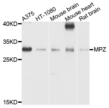 MPZ / P0 Antibody - Western blot analysis of extracts of various cell lines, using MPZ antibody at 1:1000 dilution. The secondary antibody used was an HRP Goat Anti-Rabbit IgG (H+L) at 1:10000 dilution. Lysates were loaded 25ug per lane and 3% nonfat dry milk in TBST was used for blocking. An ECL Kit was used for detection and the exposure time was 60s.