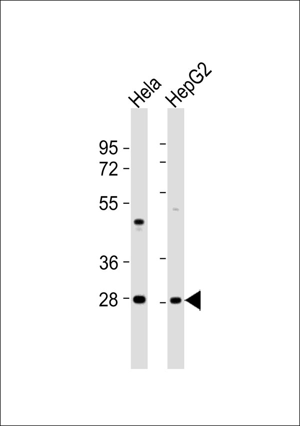 MPZ / P0 Antibody - All lanes : Anti-MPZ Antibody at 1:1000 dilution Lane 1: HeLa whole cell lysates Lane 2: HepG2 whole cell lysates Lysates/proteins at 20 ug per lane. Secondary Goat Anti-Rabbit IgG, (H+L),Peroxidase conjugated at 1/10000 dilution Predicted band size : 28 kDa Blocking/Dilution buffer: 5% NFDM/TBST.