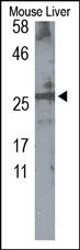MPZ / P0 Antibody - The Myelin P0 Protein Antibody is used at 1:100 in Western blot to detect Myelin P0 in mouse liver lysates.