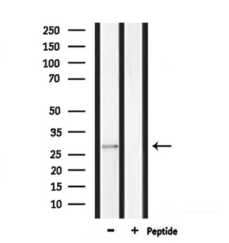 MPZ / P0 Antibody - Western blot analysis of extracts of rat muscle using MPZ antibody.
