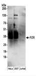 MPZL1 Antibody - Detection of Human PZR by Western Blot. Samples: Whole cell lysate (50 ug) prepared using NETN buffer from HeLa, 293T, and Jurkat cells. Antibodies: Affinity purified rabbit anti-PZR antibody used for WB at 0.1 ug/ml. Detection: Chemiluminescence with an exposure time of 3 minutes.