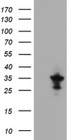 MPZL2 Antibody - HEK293T cells were transfected with the pCMV6-ENTRY control (Left lane) or pCMV6-ENTRY MPZL2 (Right lane) cDNA for 48 hrs and lysed. Equivalent amounts of cell lysates (5 ug per lane) were separated by SDS-PAGE and immunoblotted with anti-MPZL2.